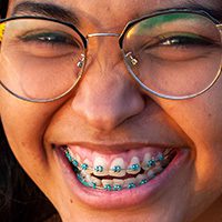 Myths About Braces Teeth Q Dental Surgeons