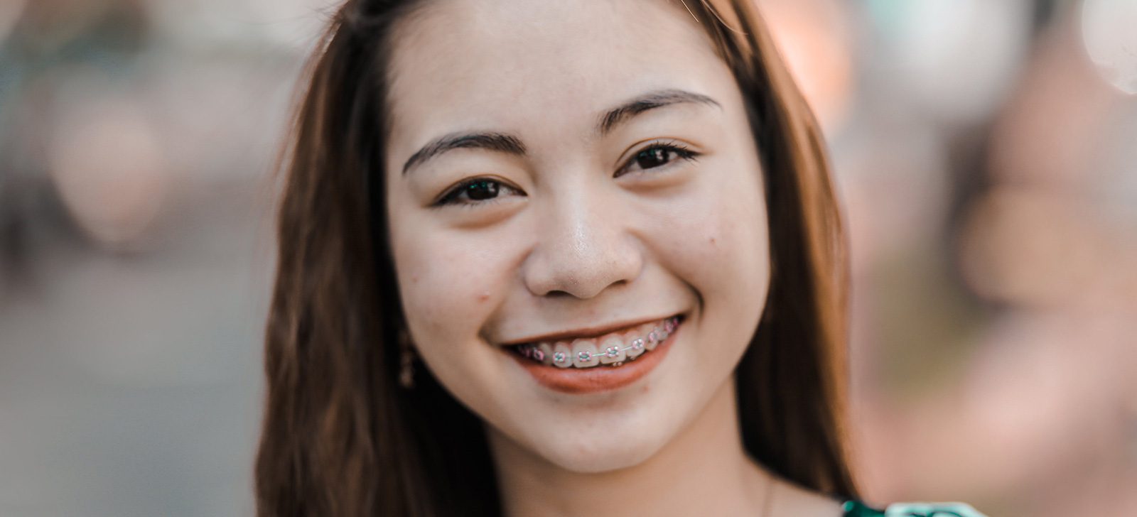 Illustrative photo of a smiling person wearing metal braces