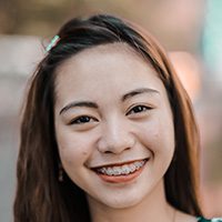 6 Tips for Maintaining Good Oral Hygiene with Braces