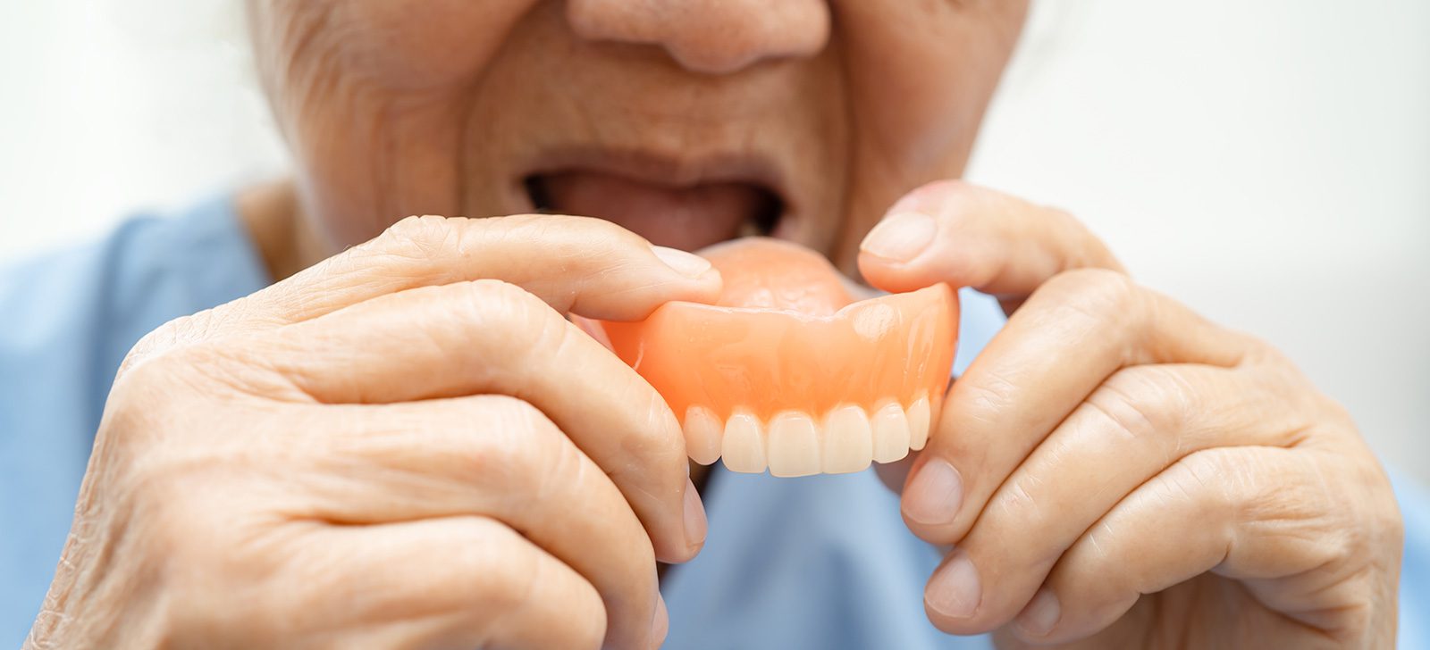 Dentures in Singapore: Types, Comfort, Costs and Daily Care