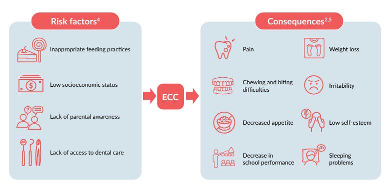 Risk factors and consequences for early childhood caries