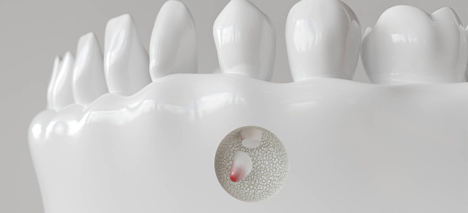 Illustration related to root-end surgery