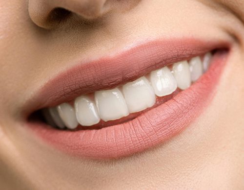 Smile bright white teeth after ICON treatment