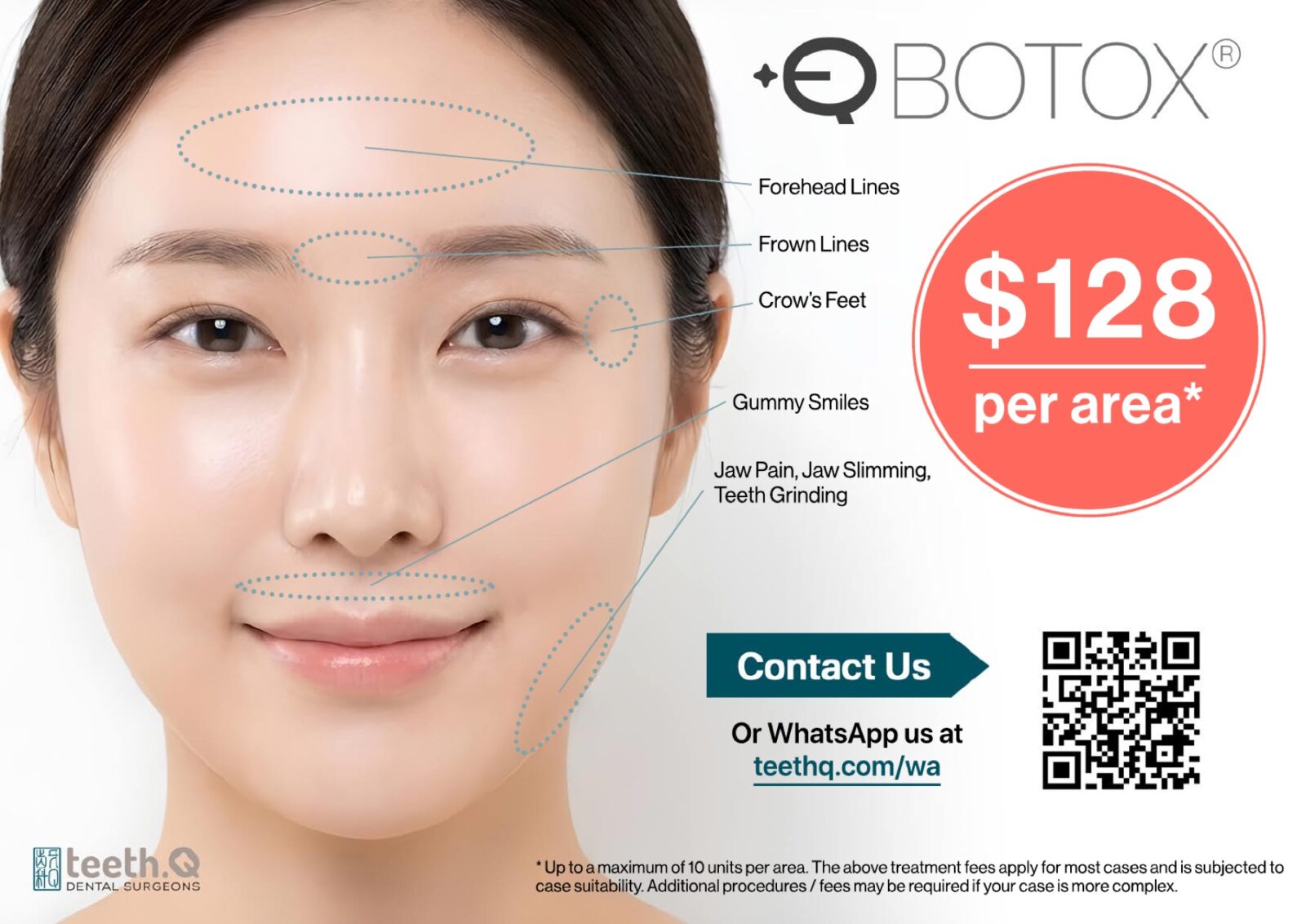 Q Botox treatment areas and $128 per area clinic information